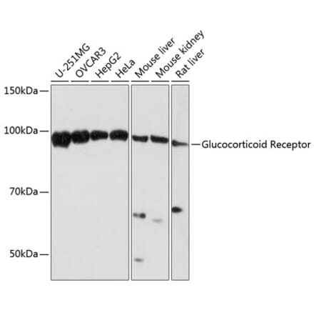 Western Blot - Anti-Glucocorticoid Receptor Antibody [ARC0062] (A305646) - Antibodies.com
