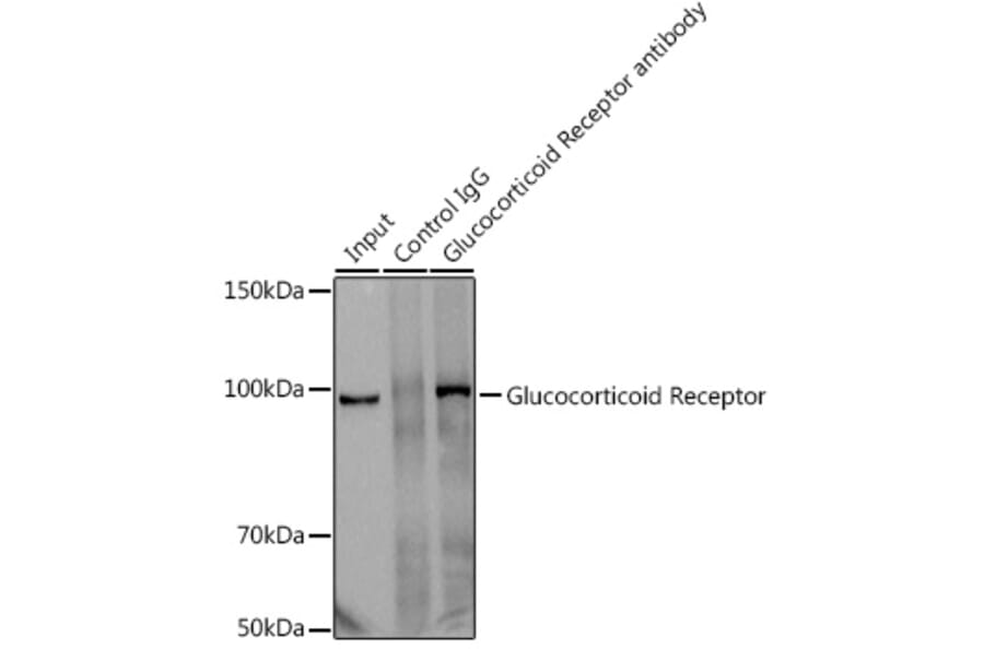 Western Blot - Anti-Glucocorticoid Receptor Antibody [ARC0062] (A305646) - Antibodies.com