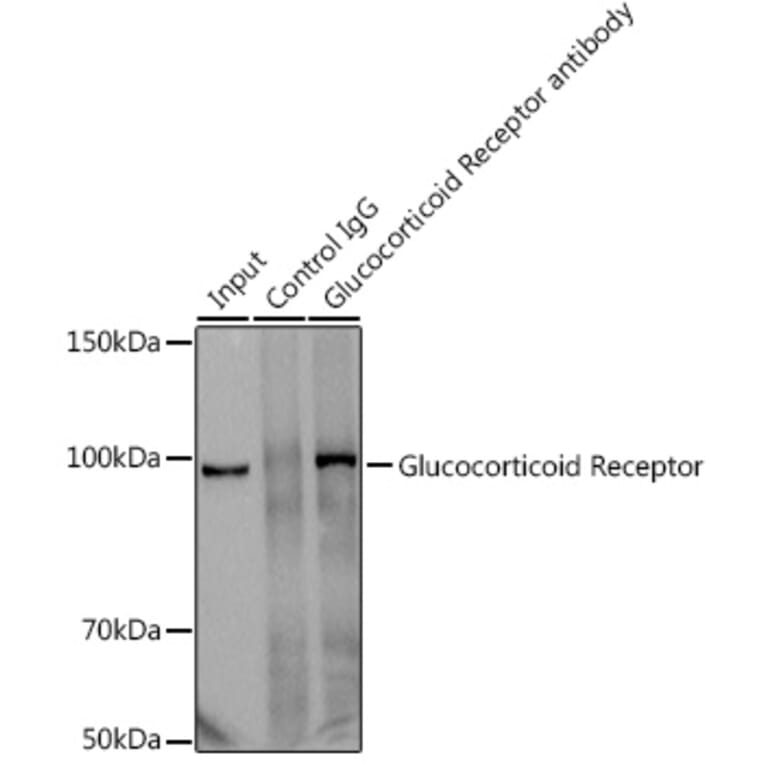 Western Blot - Anti-Glucocorticoid Receptor Antibody [ARC0062] (A305646) - Antibodies.com