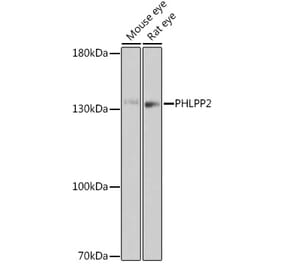Western Blot - Anti-PHLPP2 Antibody (A305647) - Antibodies.com
