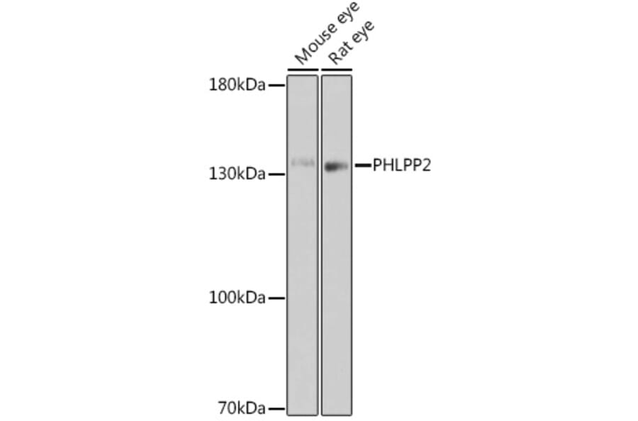 Western Blot - Anti-PHLPP2 Antibody (A305647) - Antibodies.com