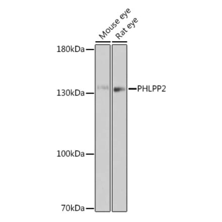 Western Blot - Anti-PHLPP2 Antibody (A305647) - Antibodies.com