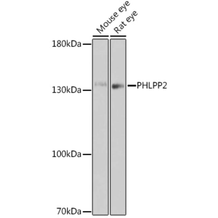 Western Blot - Anti-PHLPP2 Antibody (A305647) - Antibodies.com