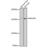 Western Blot - Anti-PHLPP2 Antibody (A305647) - Antibodies.com