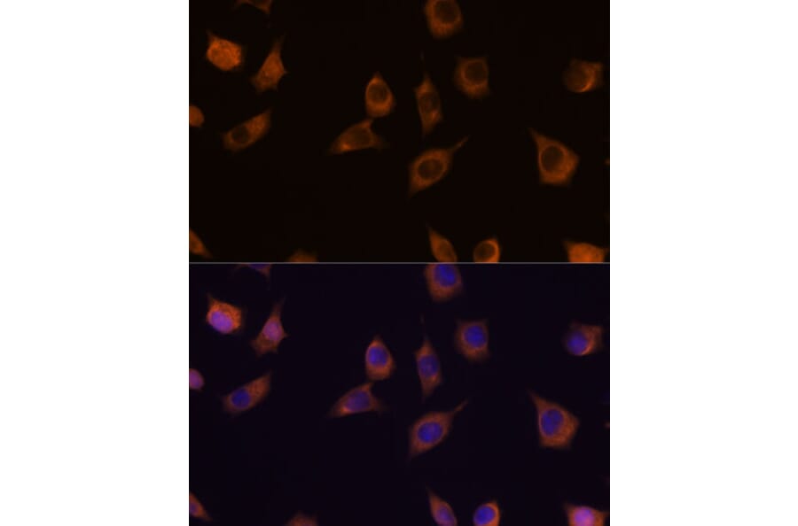 Immunofluorescence - Anti-PHLPP2 Antibody (A305647) - Antibodies.com