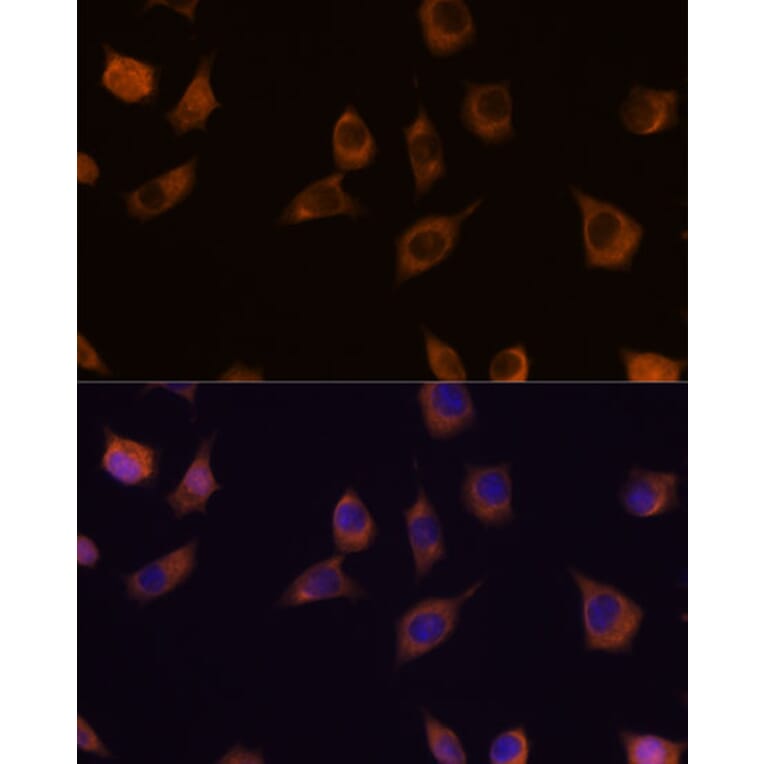 Immunofluorescence - Anti-PHLPP2 Antibody (A305647) - Antibodies.com