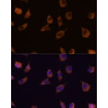 Immunofluorescence - Anti-PHLPP2 Antibody (A305647) - Antibodies.com