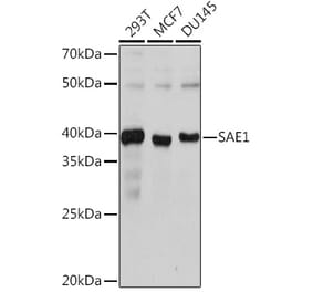 Western Blot - Anti-SAE1 Antibody [ARC1846] (A305649) - Antibodies.com