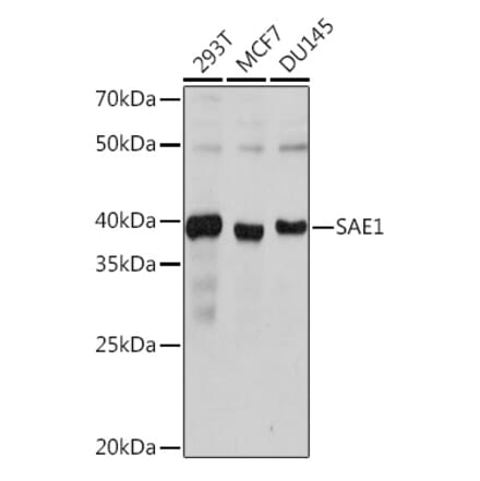 Western Blot - Anti-SAE1 Antibody [ARC1846] (A305649) - Antibodies.com