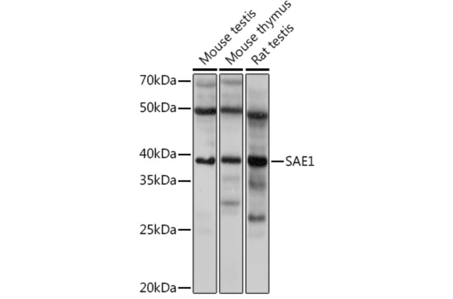 Western Blot - Anti-SAE1 Antibody [ARC1846] (A305649) - Antibodies.com