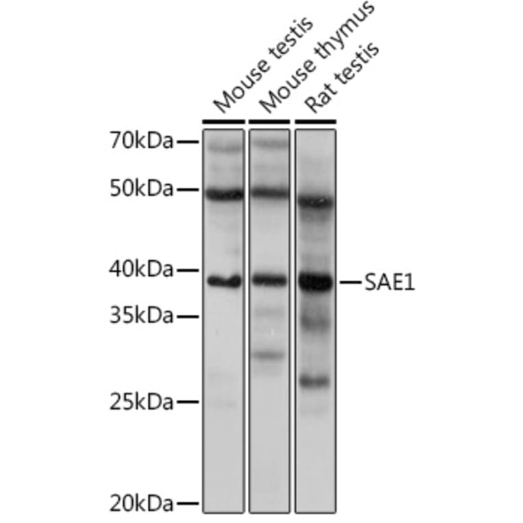 Western Blot - Anti-SAE1 Antibody [ARC1846] (A305649) - Antibodies.com