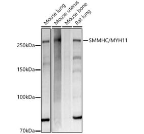 Western Blot - Anti-smooth muscle Myosin heavy chain 11 Antibody [ARC51916] (A305651) - Antibodies.com