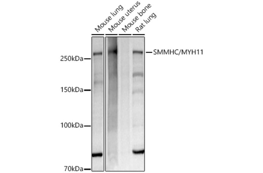 Western Blot - Anti-smooth muscle Myosin heavy chain 11 Antibody [ARC51916] (A305651) - Antibodies.com