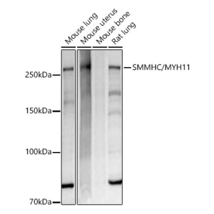 Western Blot - Anti-smooth muscle Myosin heavy chain 11 Antibody [ARC51916] (A305651) - Antibodies.com