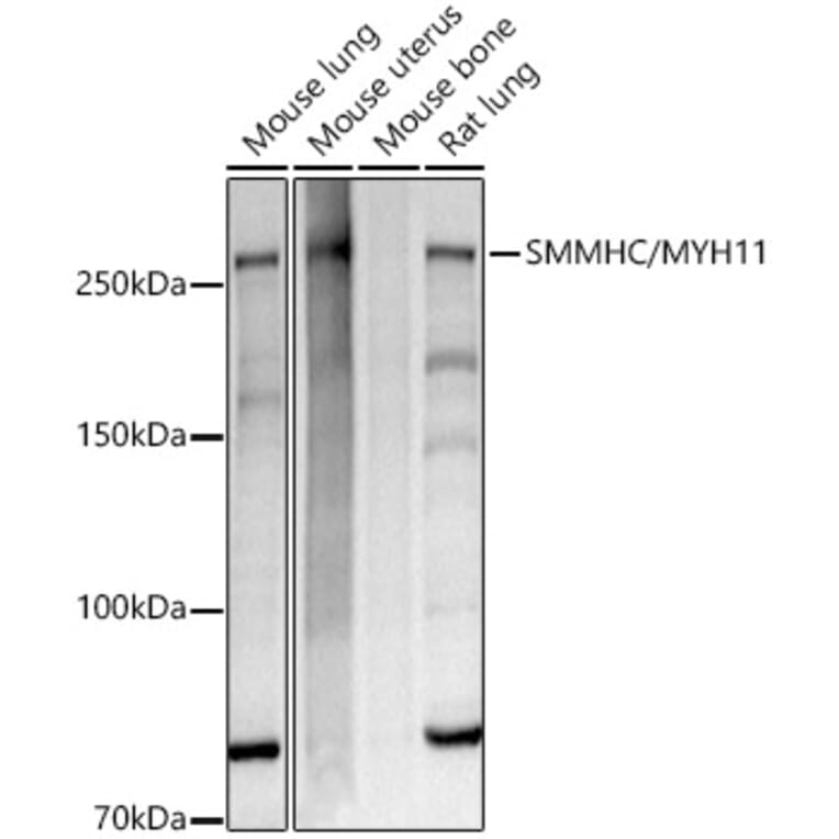 Western Blot - Anti-smooth muscle Myosin heavy chain 11 Antibody [ARC51916] (A305651) - Antibodies.com