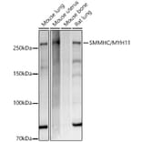 Western Blot - Anti-smooth muscle Myosin heavy chain 11 Antibody [ARC51916] (A305651) - Antibodies.com