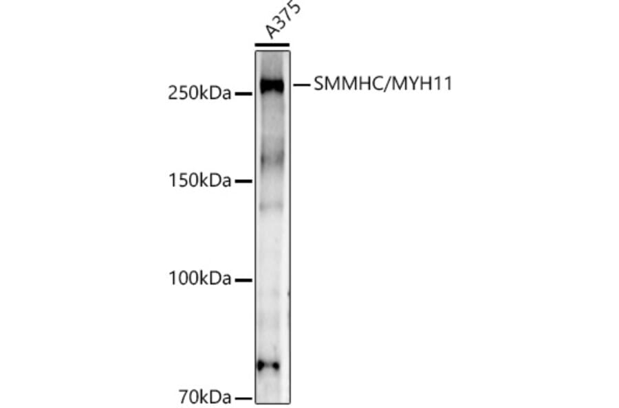Western Blot - Anti-smooth muscle Myosin heavy chain 11 Antibody [ARC51916] (A305651) - Antibodies.com