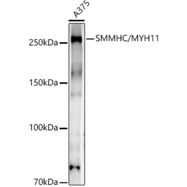 Western Blot - Anti-smooth muscle Myosin heavy chain 11 Antibody [ARC51916] (A305651) - Antibodies.com