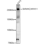 Western Blot - Anti-smooth muscle Myosin heavy chain 11 Antibody [ARC51916] (A305651) - Antibodies.com
