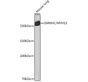 Western Blot - Anti-smooth muscle Myosin heavy chain 11 Antibody [ARC51911] (A305652) - Antibodies.com