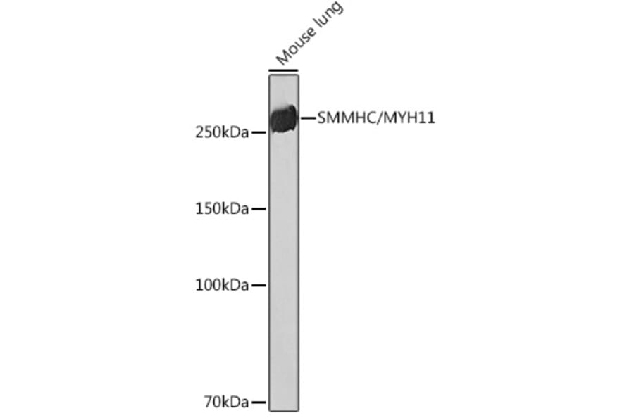 Western Blot - Anti-smooth muscle Myosin heavy chain 11 Antibody [ARC51911] (A305652) - Antibodies.com