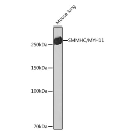 Western Blot - Anti-smooth muscle Myosin heavy chain 11 Antibody [ARC51911] (A305652) - Antibodies.com