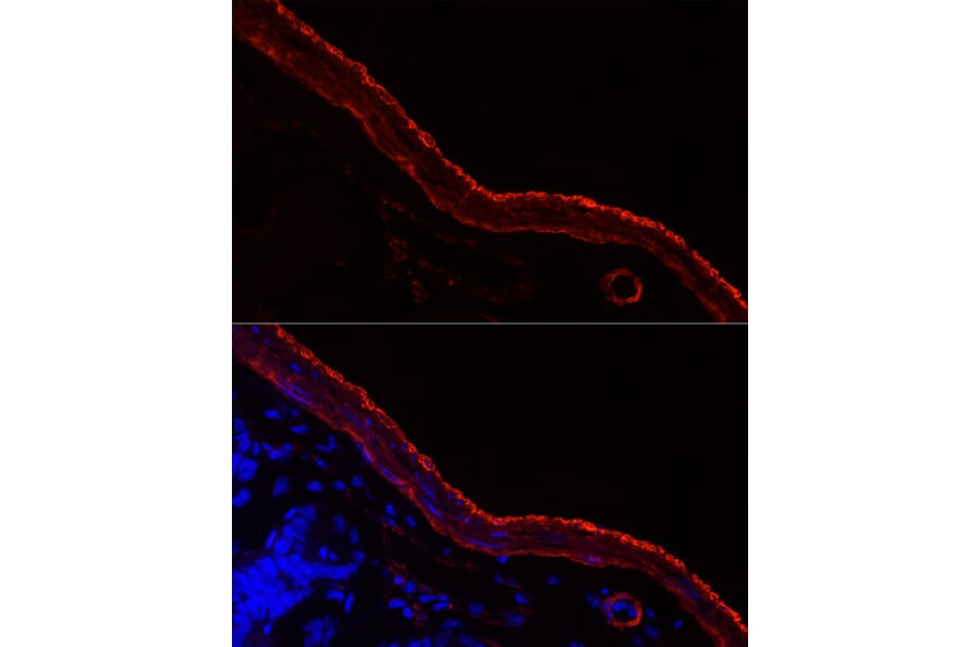 Immunofluorescence - Anti-smooth muscle Myosin heavy chain 11 Antibody [ARC51911] (A305652) - Antibodies.com