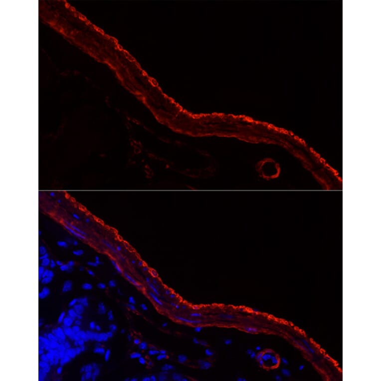 Immunofluorescence - Anti-smooth muscle Myosin heavy chain 11 Antibody [ARC51911] (A305652) - Antibodies.com