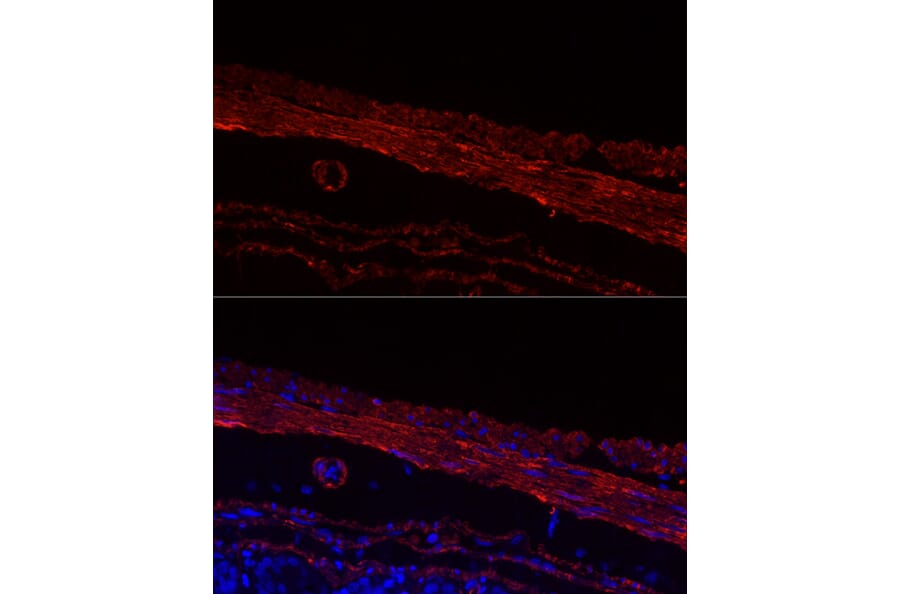Immunofluorescence - Anti-smooth muscle Myosin heavy chain 11 Antibody [ARC51911] (A305652) - Antibodies.com