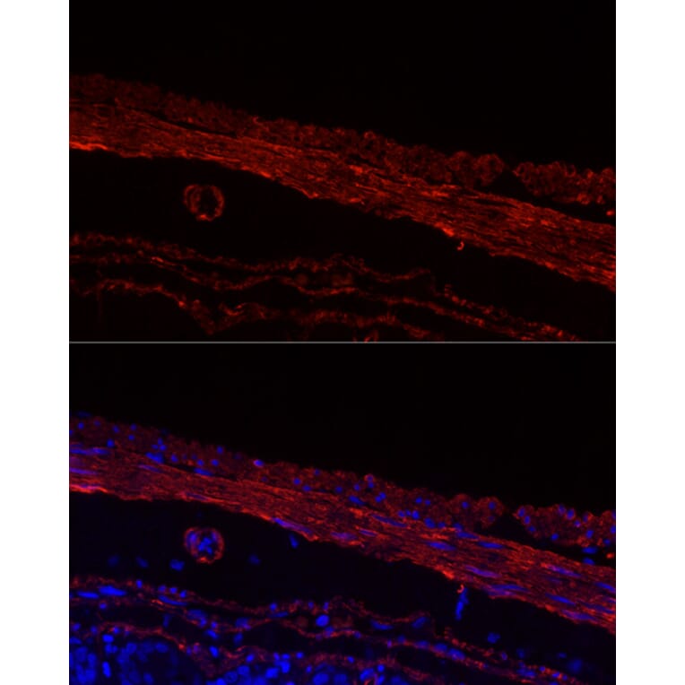 Immunofluorescence - Anti-smooth muscle Myosin heavy chain 11 Antibody [ARC51911] (A305652) - Antibodies.com