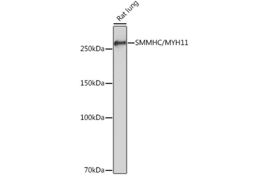 Western Blot - Anti-smooth muscle Myosin heavy chain 11 Antibody [ARC51911] (A305652) - Antibodies.com