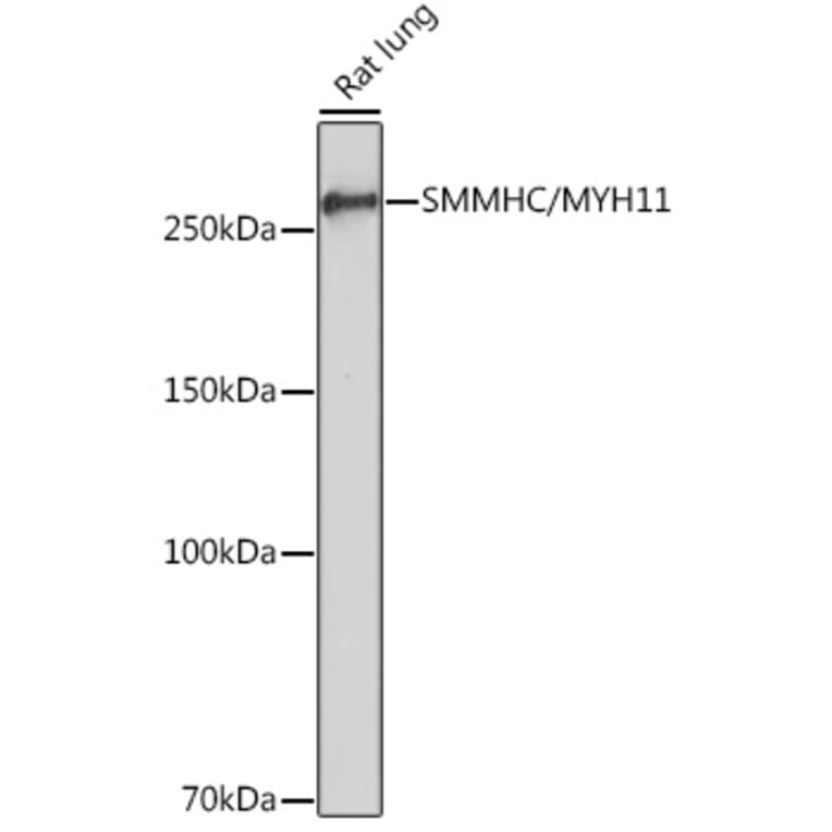 Western Blot - Anti-smooth muscle Myosin heavy chain 11 Antibody [ARC51911] (A305652) - Antibodies.com