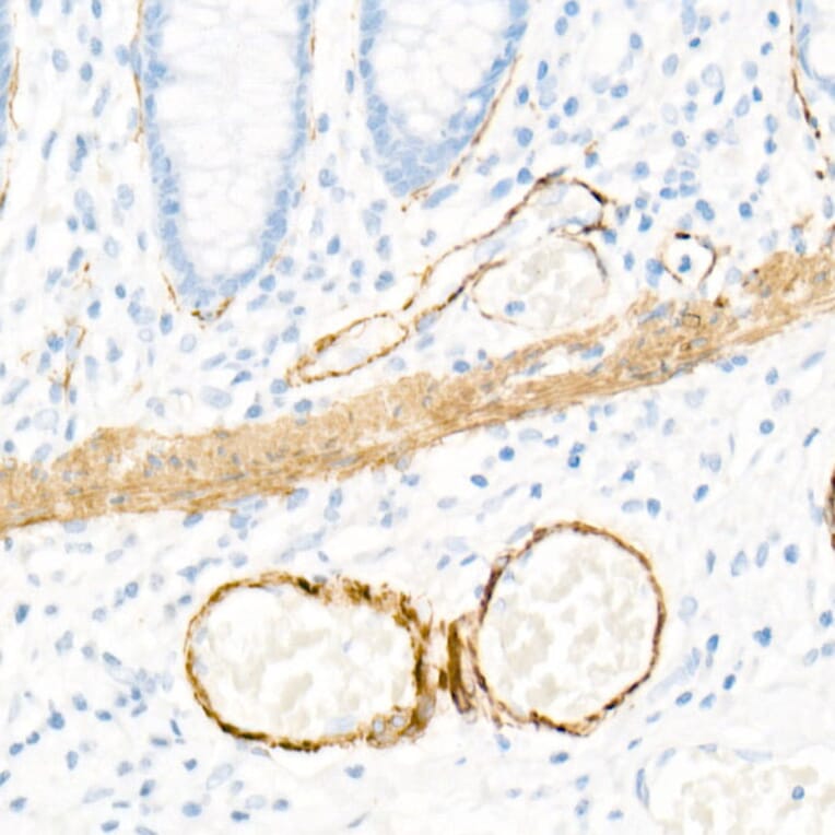 Immunohistochemistry - Anti-smooth muscle Myosin heavy chain 11 Antibody [ARC51911] (A305652) - Antibodies.com