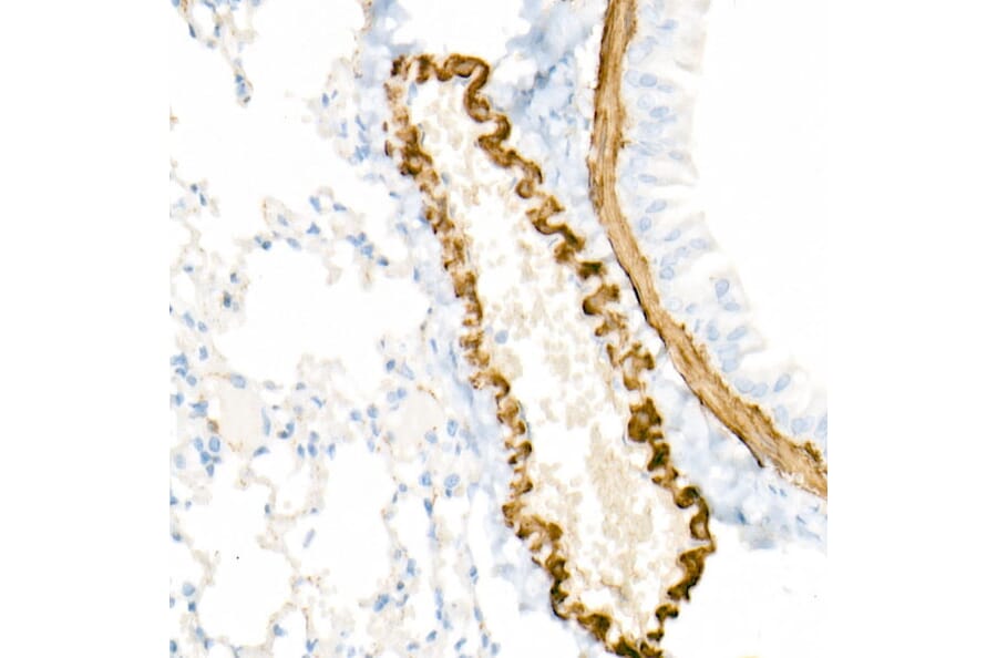 Immunohistochemistry - Anti-smooth muscle Myosin heavy chain 11 Antibody [ARC51911] (A305652) - Antibodies.com