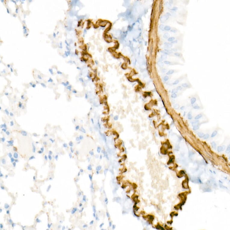 Immunohistochemistry - Anti-smooth muscle Myosin heavy chain 11 Antibody [ARC51911] (A305652) - Antibodies.com