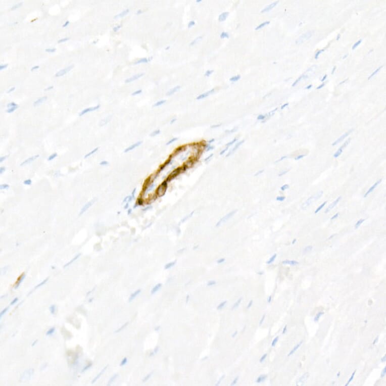 Immunohistochemistry - Anti-smooth muscle Myosin heavy chain 11 Antibody [ARC51911] (A305652) - Antibodies.com