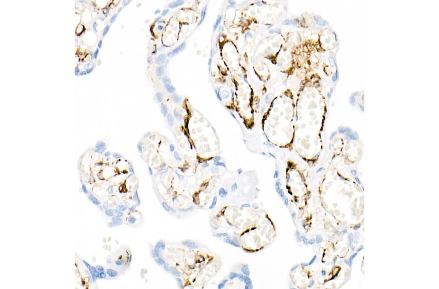 Immunohistochemistry - Anti-smooth muscle Myosin heavy chain 11 Antibody [ARC51911] (A305652) - Antibodies.com