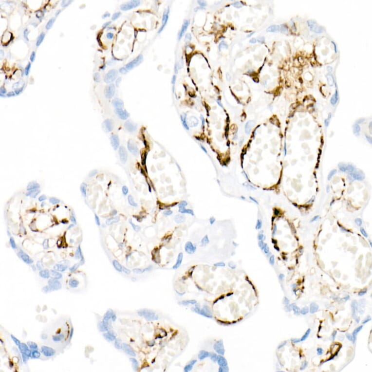 Immunohistochemistry - Anti-smooth muscle Myosin heavy chain 11 Antibody [ARC51911] (A305652) - Antibodies.com