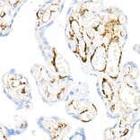 Immunohistochemistry - Anti-smooth muscle Myosin heavy chain 11 Antibody [ARC51911] (A305652) - Antibodies.com