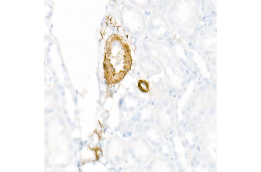 Immunohistochemistry - Anti-smooth muscle Myosin heavy chain 11 Antibody [ARC51911] (A305652) - Antibodies.com