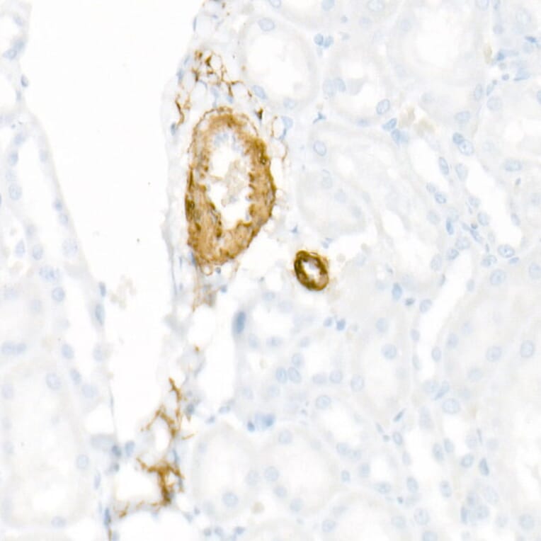Immunohistochemistry - Anti-smooth muscle Myosin heavy chain 11 Antibody [ARC51911] (A305652) - Antibodies.com