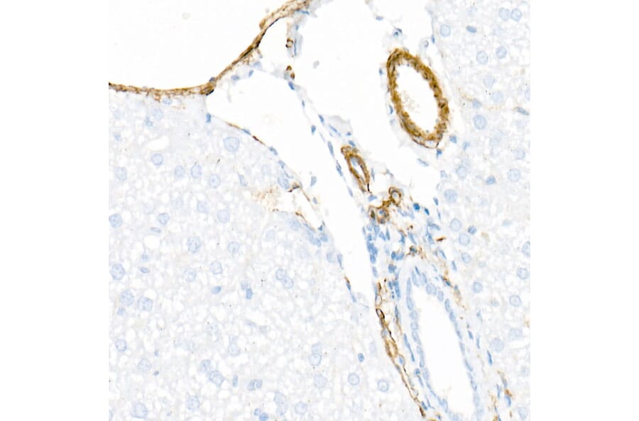 Immunohistochemistry - Anti-smooth muscle Myosin heavy chain 11 Antibody [ARC51911] (A305652) - Antibodies.com
