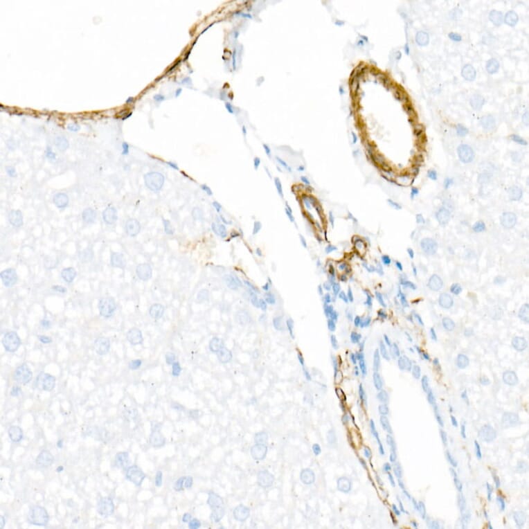 Immunohistochemistry - Anti-smooth muscle Myosin heavy chain 11 Antibody [ARC51911] (A305652) - Antibodies.com