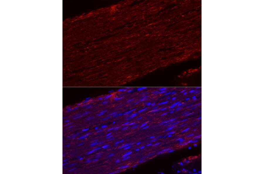 Immunofluorescence - Anti-smooth muscle Myosin heavy chain 11 Antibody [ARC51911] (A305652) - Antibodies.com