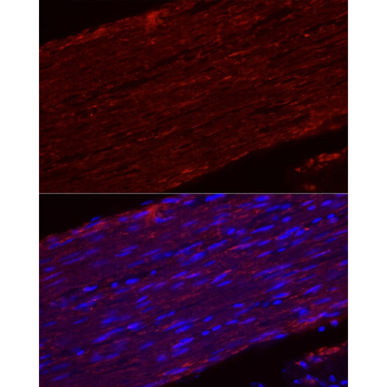 Immunofluorescence - Anti-smooth muscle Myosin heavy chain 11 Antibody [ARC51911] (A305652) - Antibodies.com