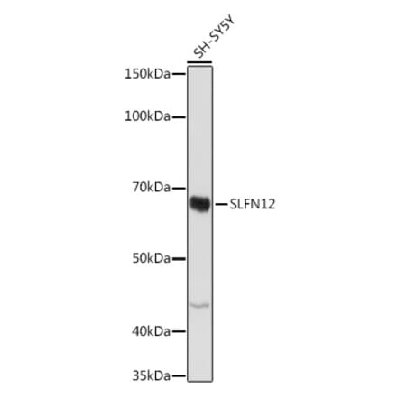 Western Blot - Anti-SLFN12 Antibody (A305653) - Antibodies.com