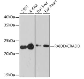 Western Blot - Anti-RAIDD Antibody [ARC1771] (A305654) - Antibodies.com