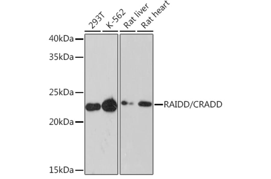 Western Blot - Anti-RAIDD Antibody [ARC1771] (A305654) - Antibodies.com