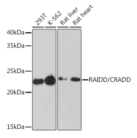 Western Blot - Anti-RAIDD Antibody [ARC1771] (A305654) - Antibodies.com