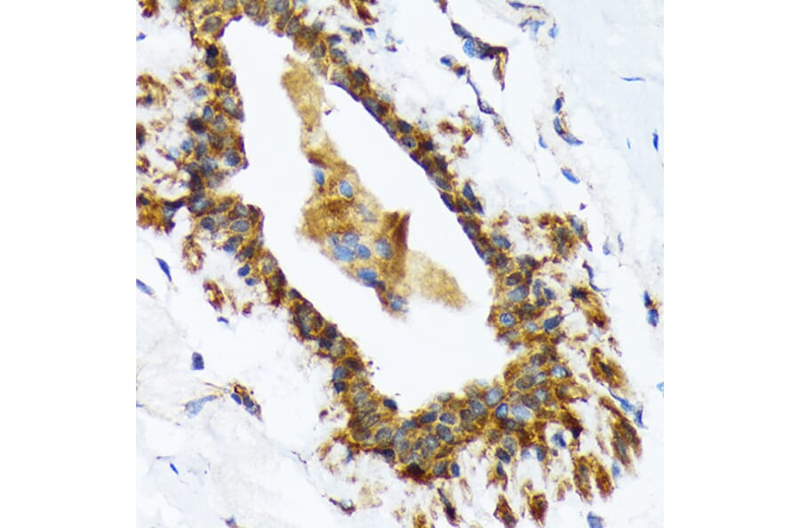 Immunohistochemistry - Anti-RAIDD Antibody [ARC1771] (A305654) - Antibodies.com